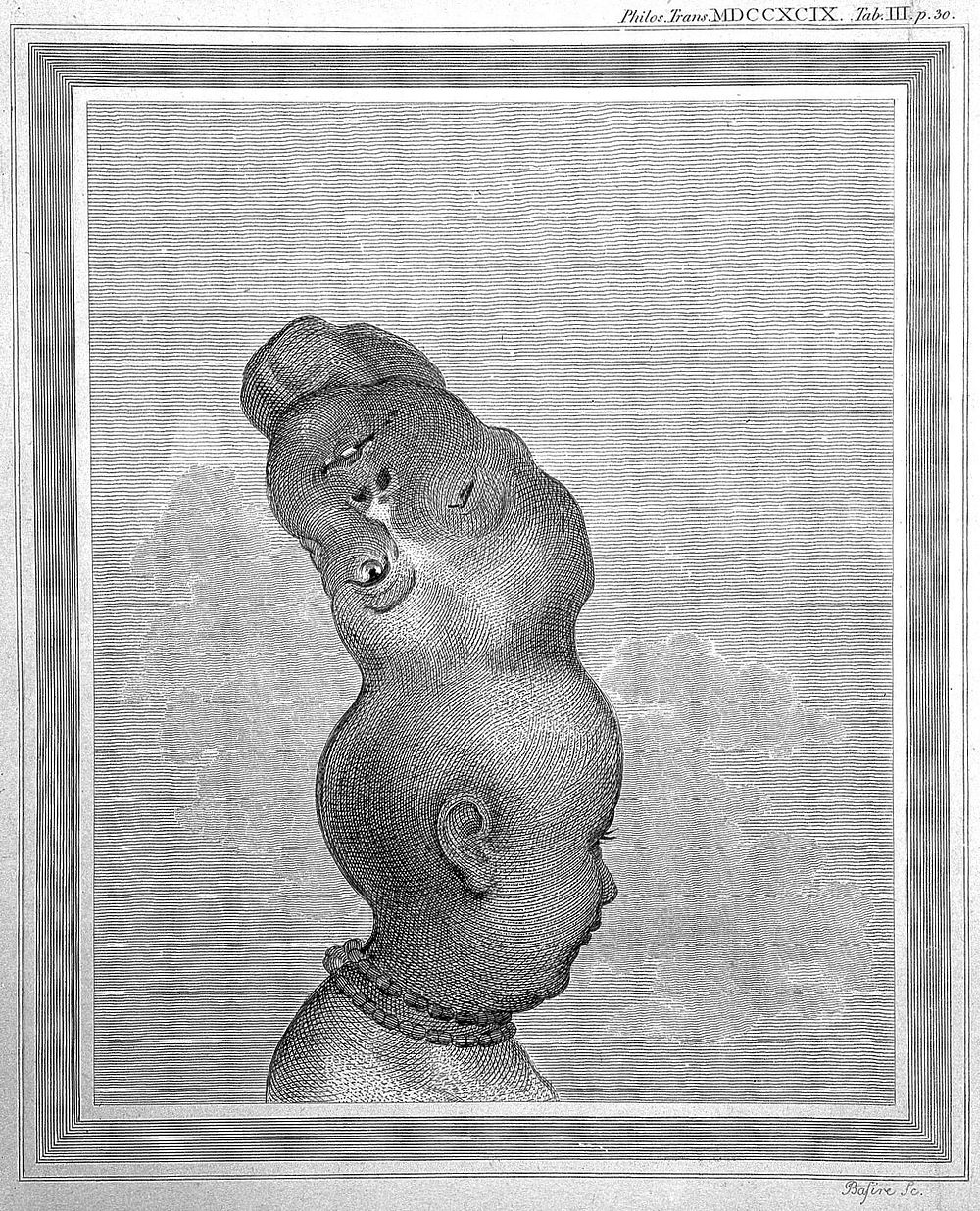 An account of a child with a double head / [Sir Everard Home].