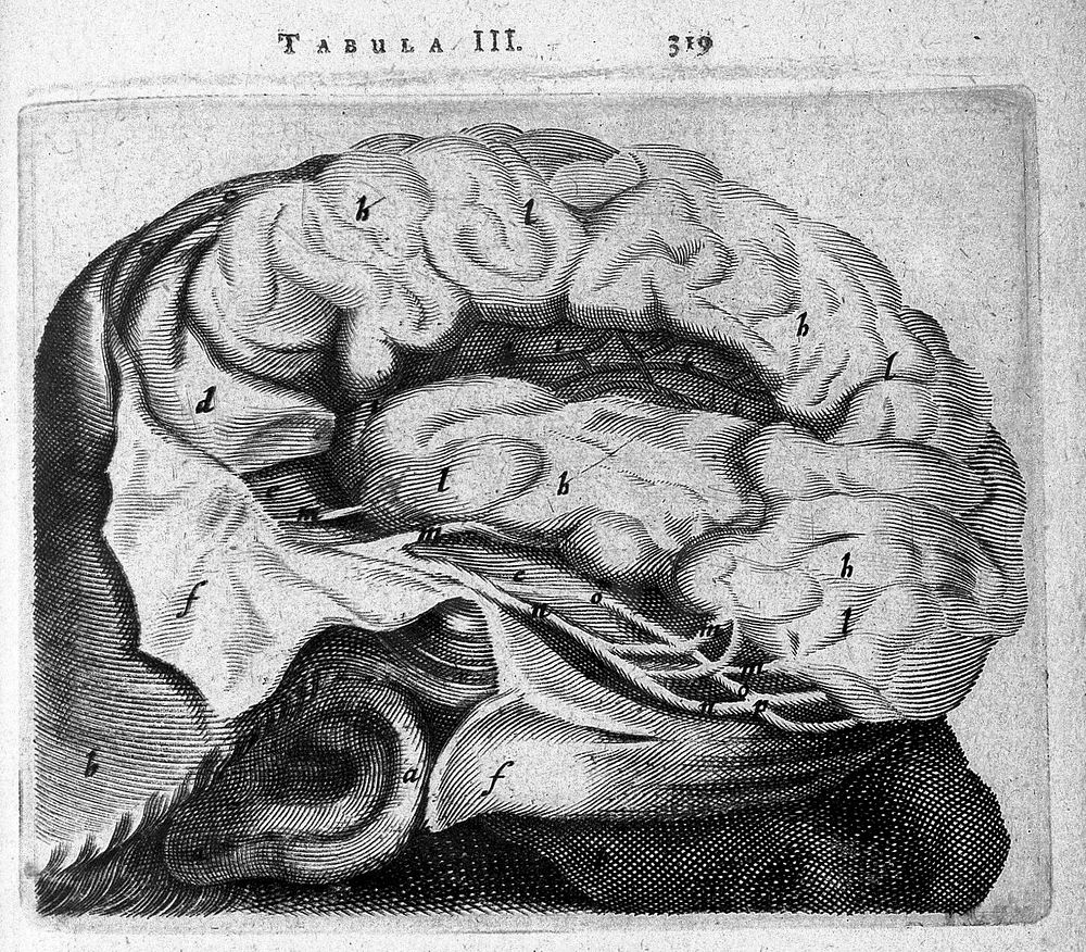 T. Bartholin, Sinistrum cerebri latus in ...