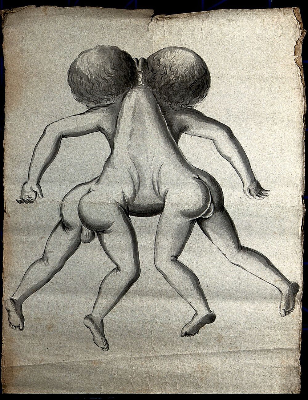 Male conjoint twins joint at the neck and chest; posterior view. Drawing, ca. 1900.