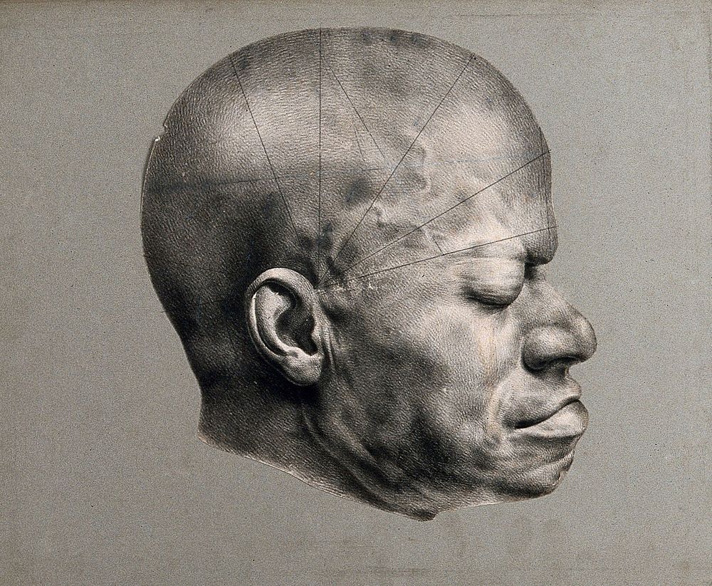 Death mask of Eustache, a slave from the Dominican republic who came to be awarded a 'prize for virtue' in 1830's Paris.…