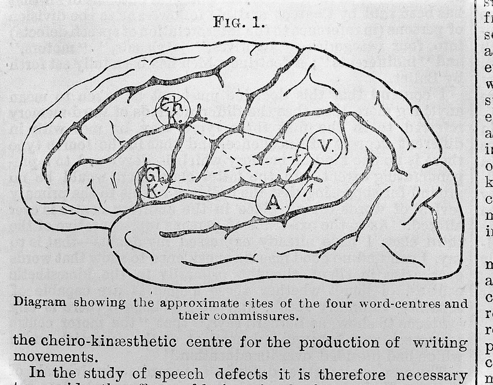 The Lancet: The brain