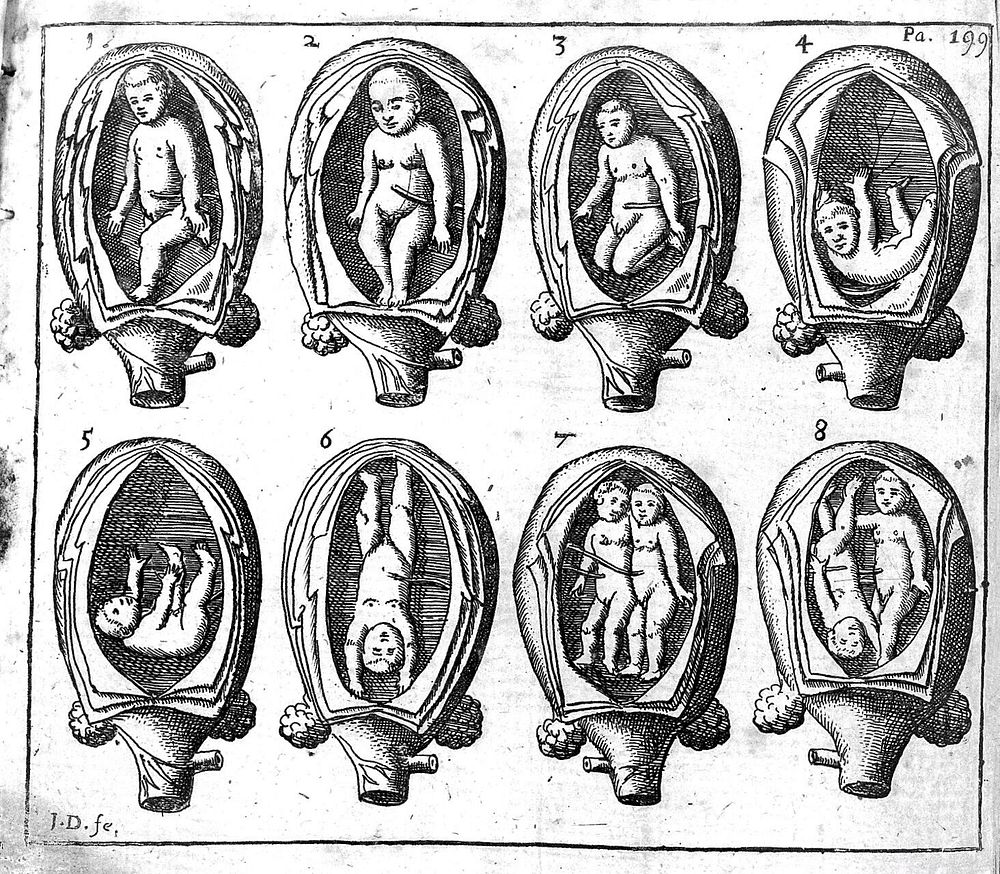 The midwives book. Or the whole art of midwifery discovered. Directing childbearing women how to behave themselves / [Jane…