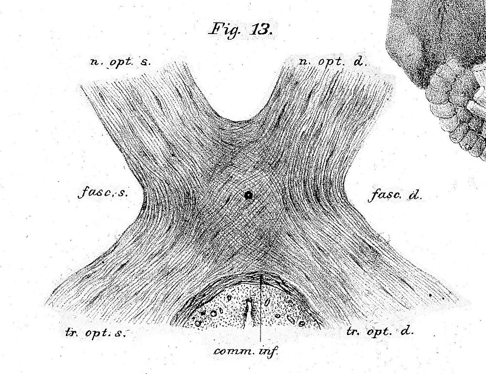 Optic chiasm, human, 19th century.