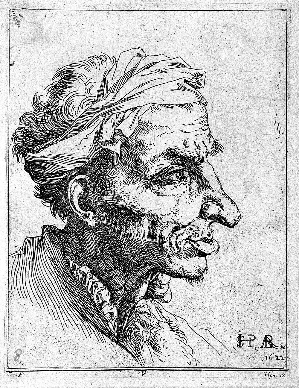 The head of a man with goitre. Etching by Jusepe de Ribera, 1622.