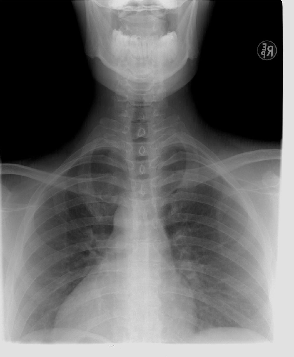 Free CT cardiac chest scan image, public domain CC0 photo.