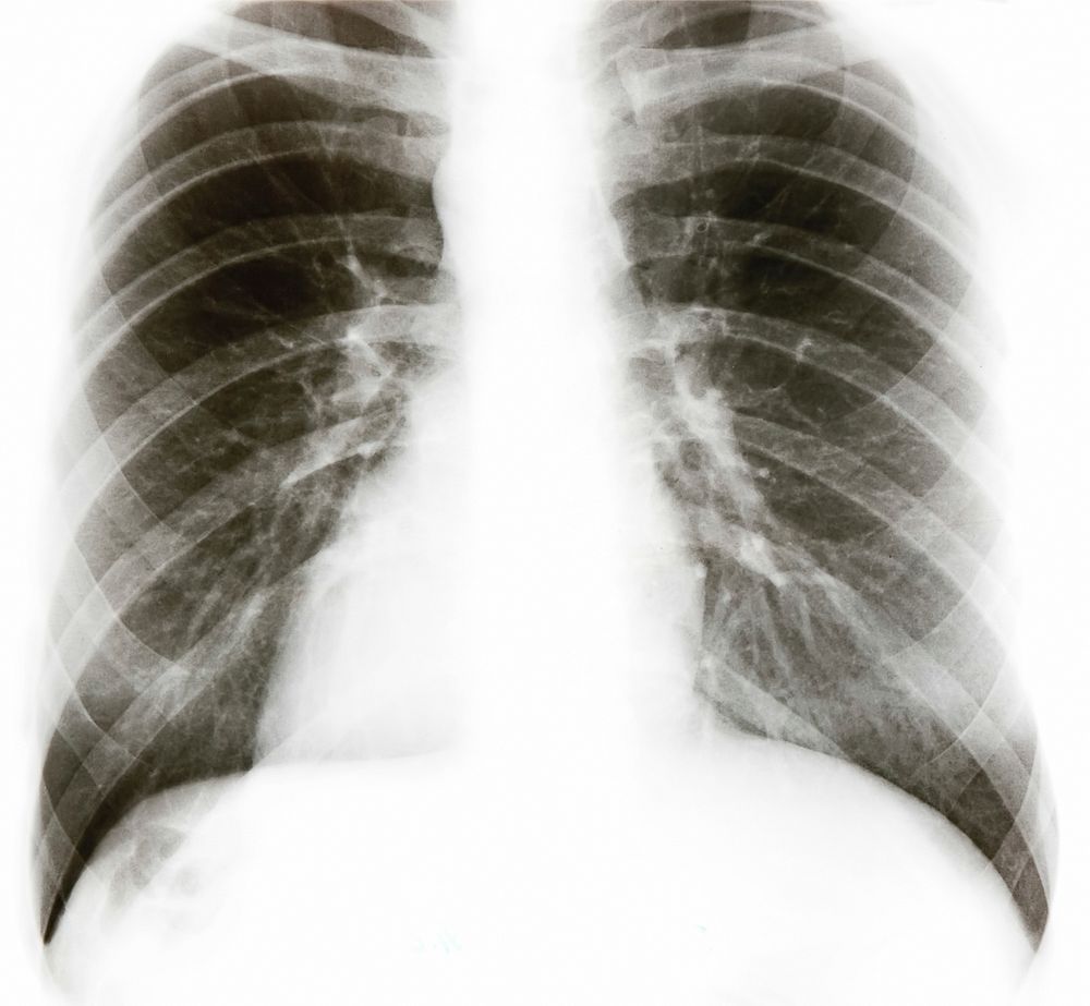 Free x-ray film image, public domain CC0 photo.