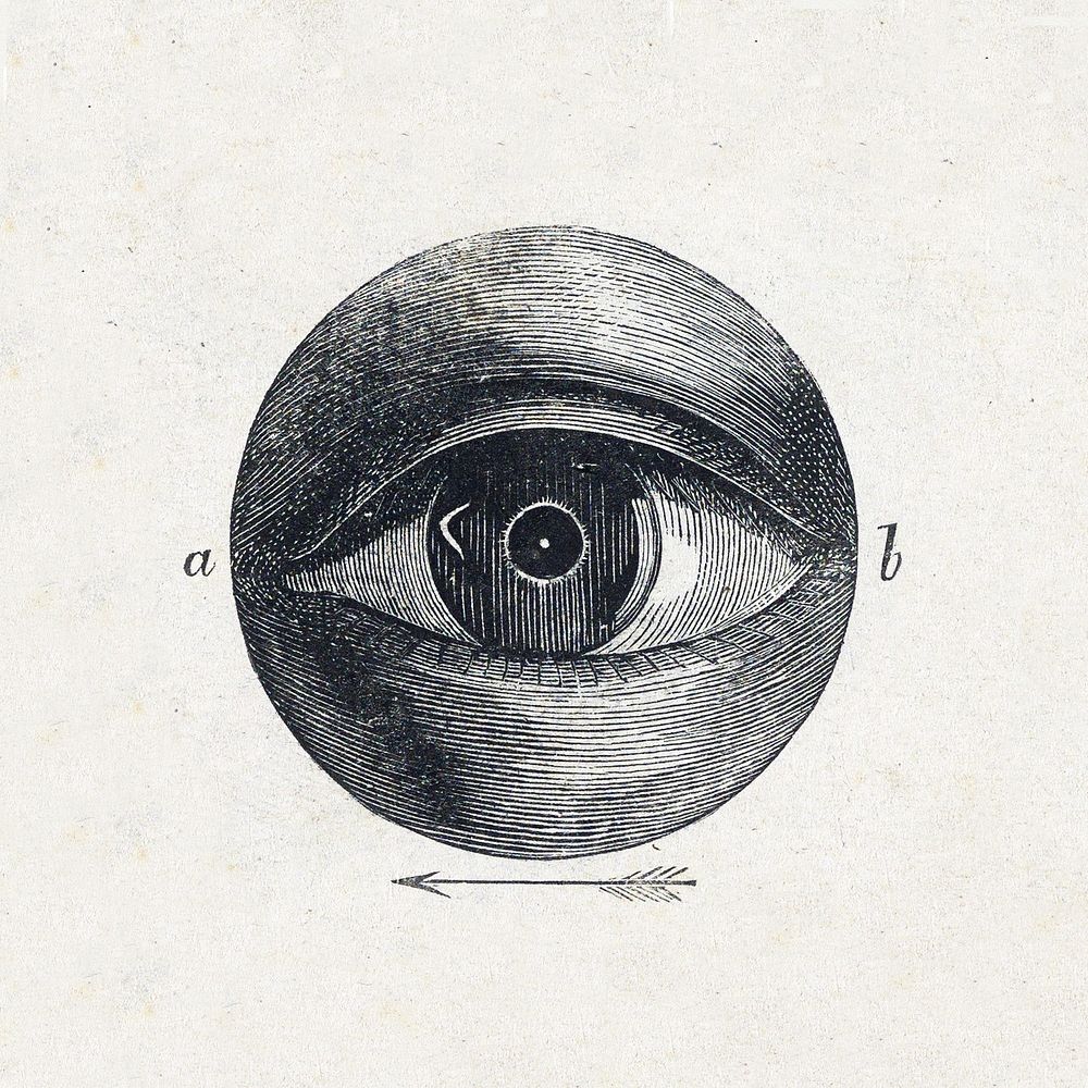 Menselijk oog met een afwijking (1836&ndash;1912) print in high resolution by Isaac Weissenbruch. Original from The…