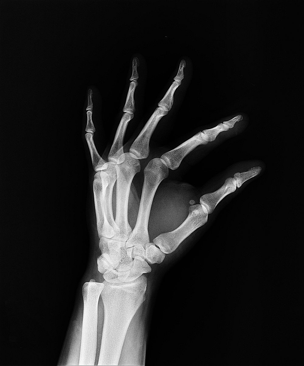Xray scan of hand. Free public domain CC0 image.