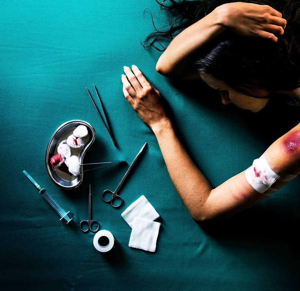 Bruised woman on a medical table