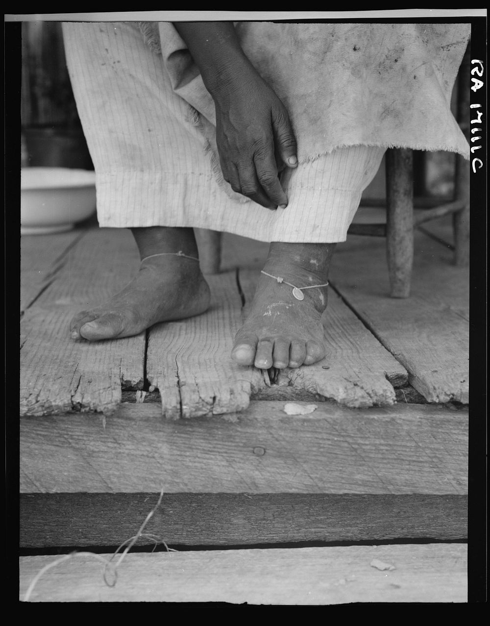 Fifty-seven year old sharecropper woman. Hinds County, Mississippi. Thin dimes around the ankles to prevent headaches by…
