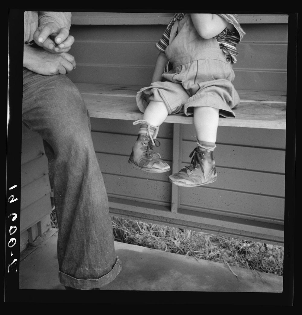 Tulare County. In Farm Security Administration (FSA) camp for migratory workers. Baby with club feet wearing homemade…