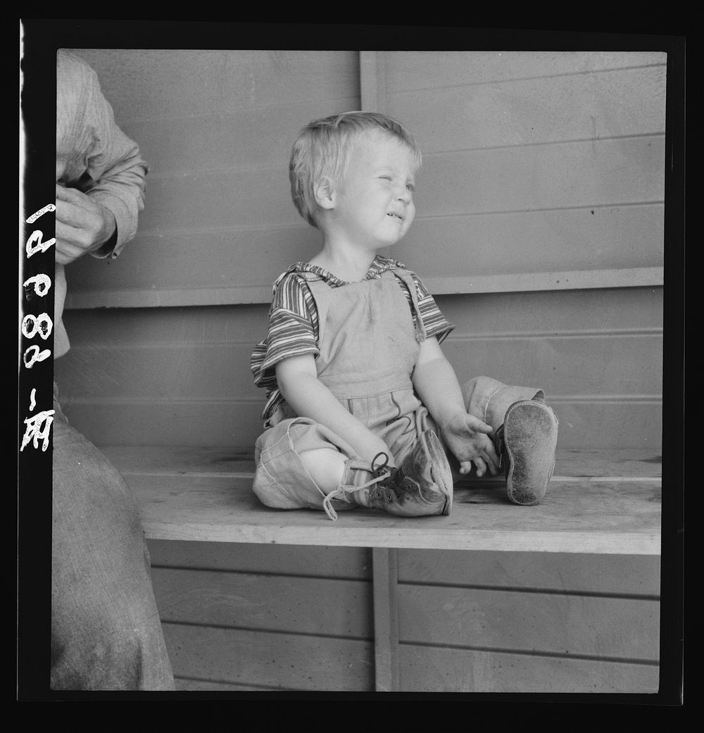 Tulare County, California. In Farm Security Administration (FSA) camp for migratory workers. Baby with club feet wearing…
