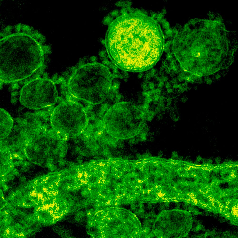 Green coronavirus under a microscope. Original image sourced from US Government department: Public Health Image Library…