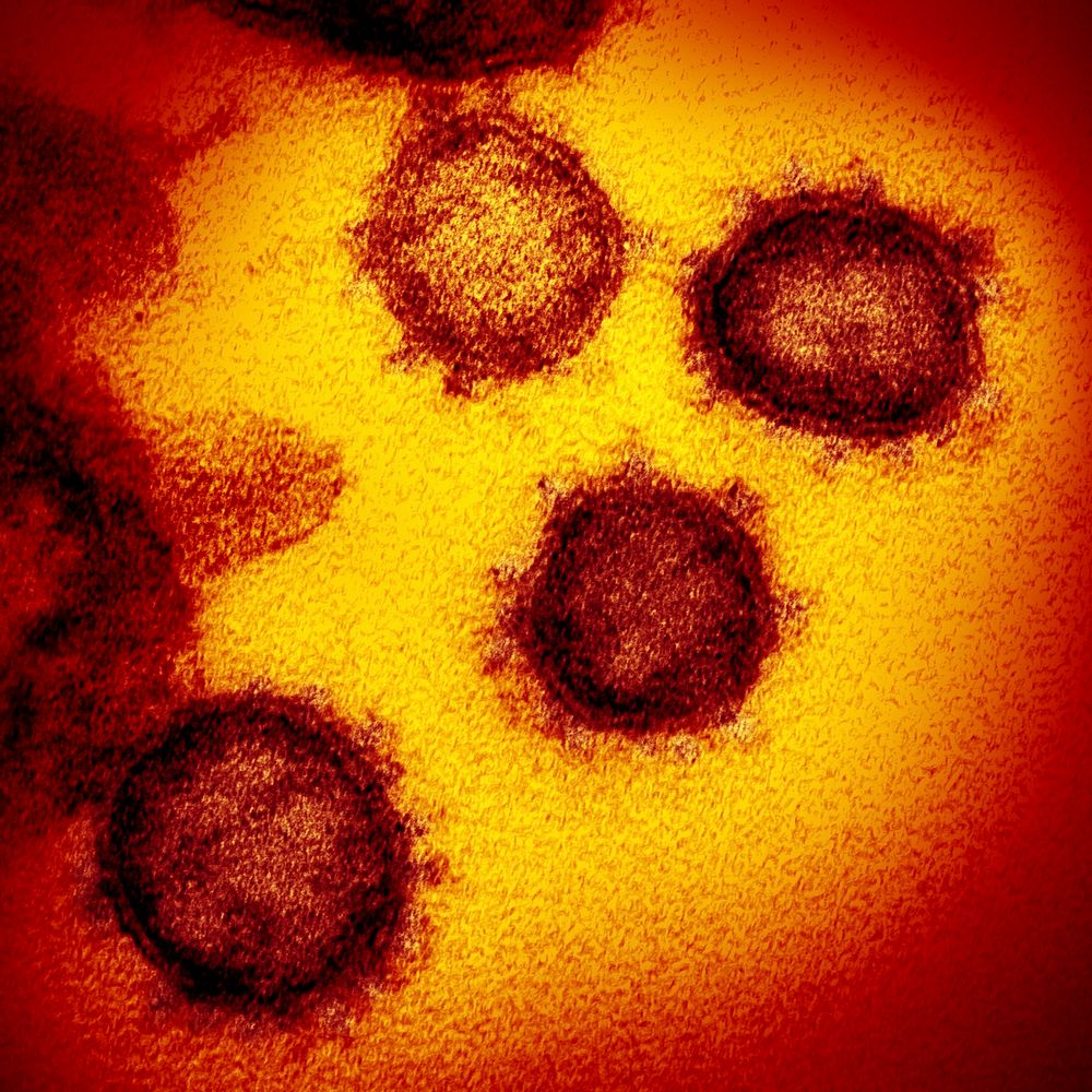 Novel Coronavirus SARS-CoV-2&ndash;This transmission electron microscope image shows SARS-CoV-2&mdash;also known as 2019…