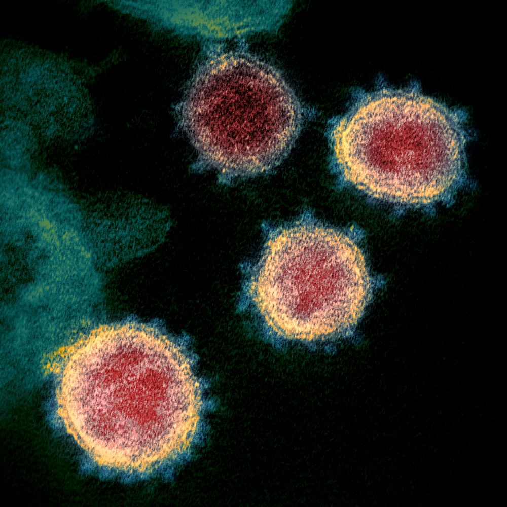 Novel Coronavirus SARS-CoV-2&ndash;This scanning electron microscope image shows SARS-CoV-2&mdash;also known as 2019-nCoV…