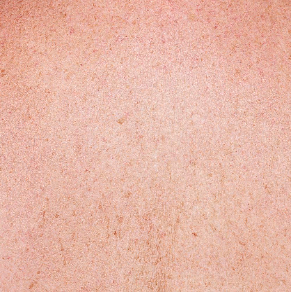 Light skin freckles complexion closeup shot