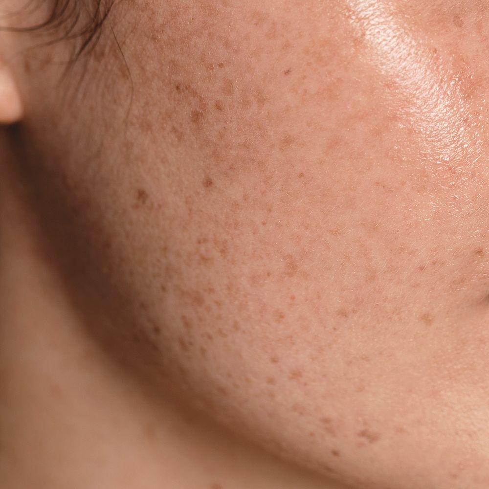 Glowing skin with freckles, close up