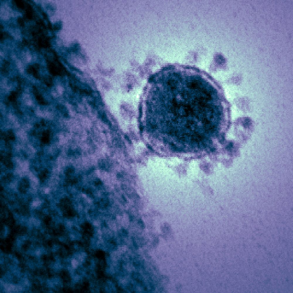 Magnified respiratory syndrome coronavirus. Original image sourced from US Government department: Public Health Image…
