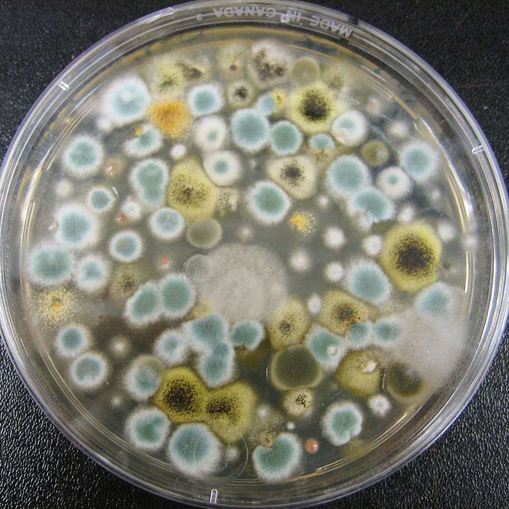 Microscopic mold. Original image sourced from US Government department: Public Health Image Library, Centers for Disease…