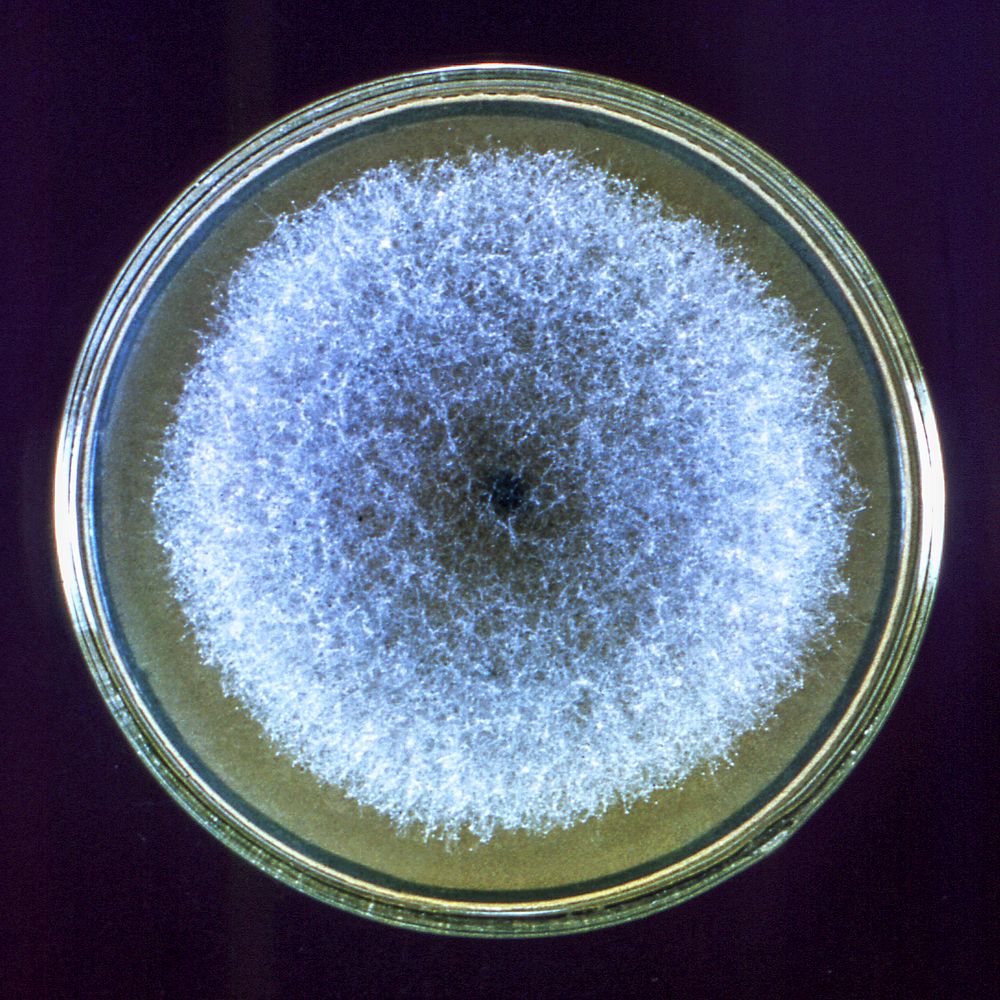 A Petri dish culture plate containing a growth medium of Sabouraud dextrose agar, which had been inoculated with the fungal…