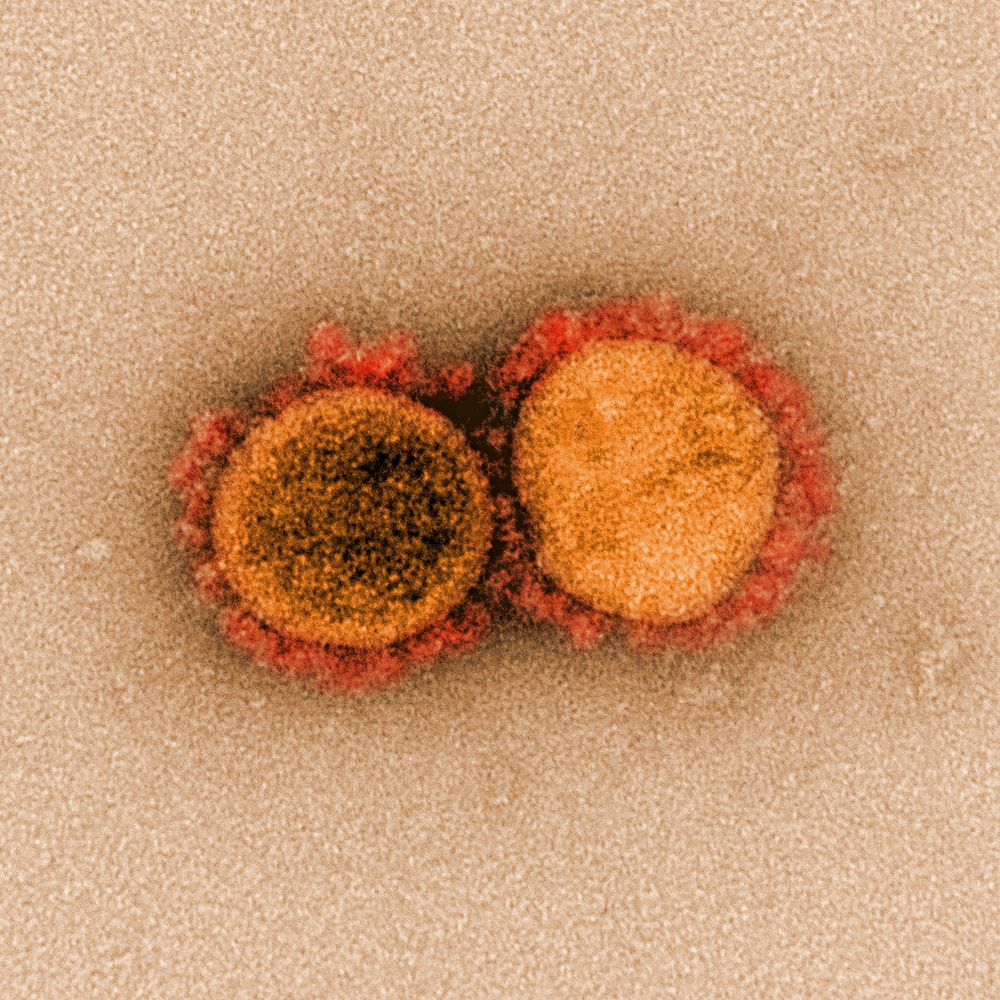 Novel Coronavirus SARS-CoV-2&ndash;Transmission electron micrograph of SARS-CoV-2 virus particles, isolated from a patient.…