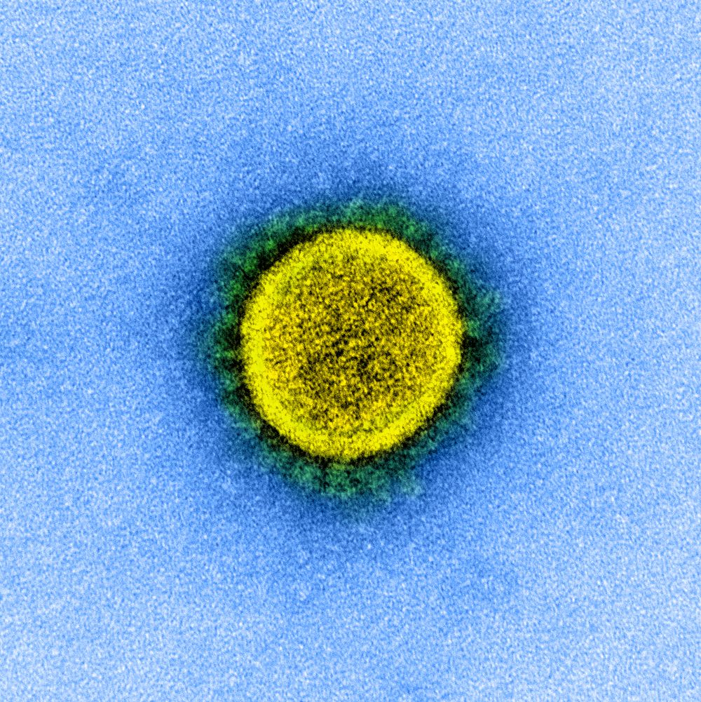 Novel Coronavirus SARS-CoV-2&ndash;Transmission electron micrograph of SARS-CoV-2 virus particles, isolated from a patient.…