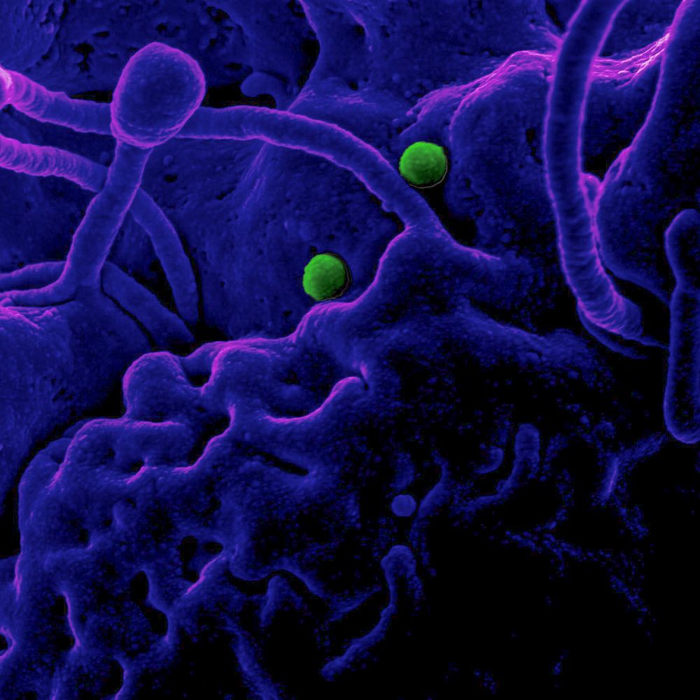 MERS Coronavirus Particles–MERS-CoV particles on camel epithelial cells. Original image sourced from US Government…