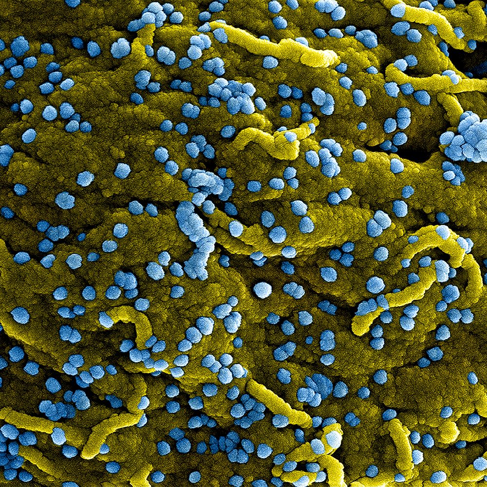 MERS Coronavirus Particles&ndash;Colorized scanning electron micrograph of Marburg virus particles (blue) both budding and…