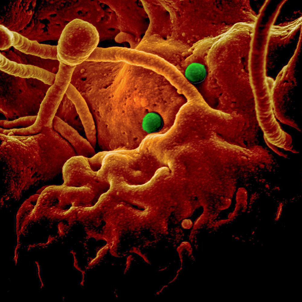 MERS Coronavirus Particles&ndash;MERS-CoV particles on camel epithelial cells. Original image sourced from US Government…