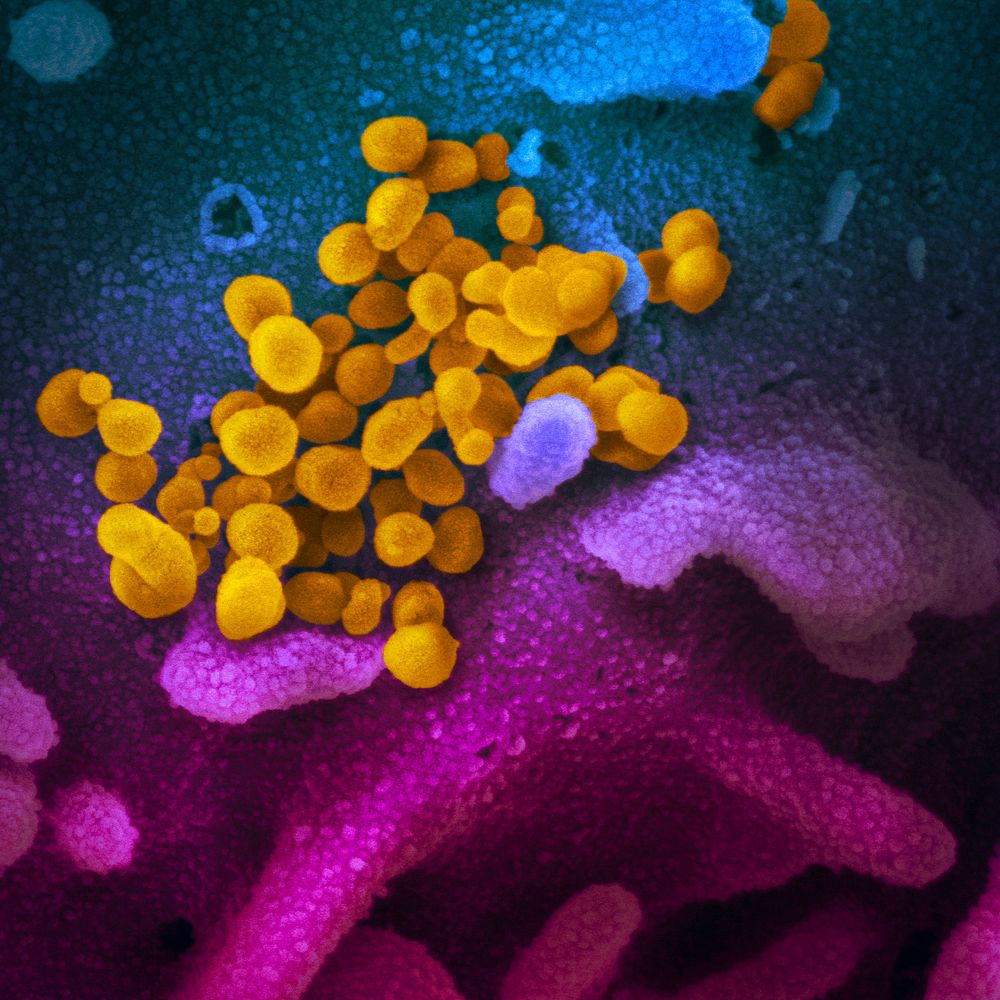 Novel Coronavirus SARS-CoV-2&ndash;This scanning electron microscope image shows SARS-CoV-2 (yellow)&mdash;also known as…