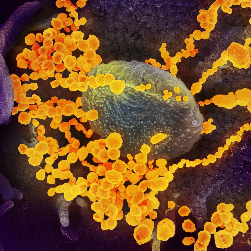 Novel Coronavirus SARS-CoV-2&ndash;This scanning electron microscope image shows SARS-CoV-2 (round gold objects) emerging…